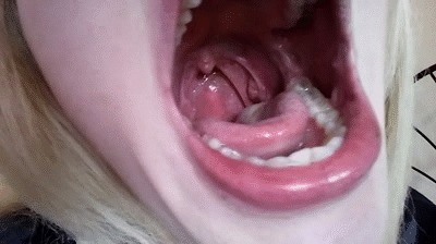 best of Uvula endoscope