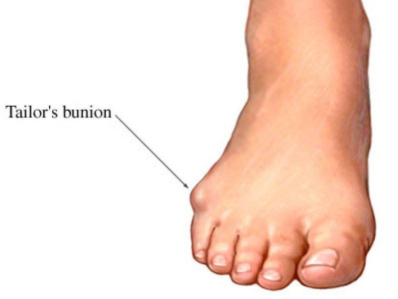 Button reccomend pain foot