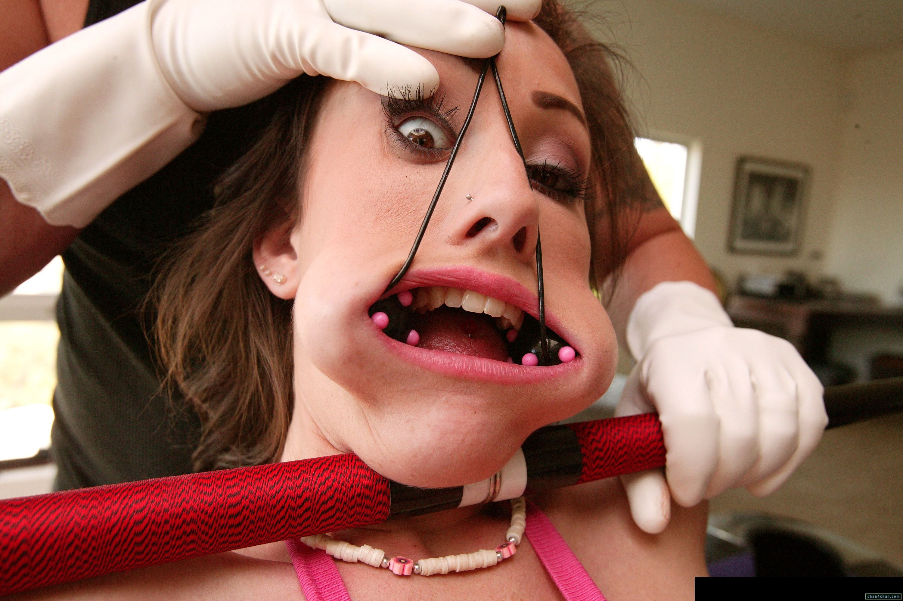 Bondage dentist