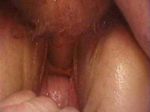 Male urethra fucking