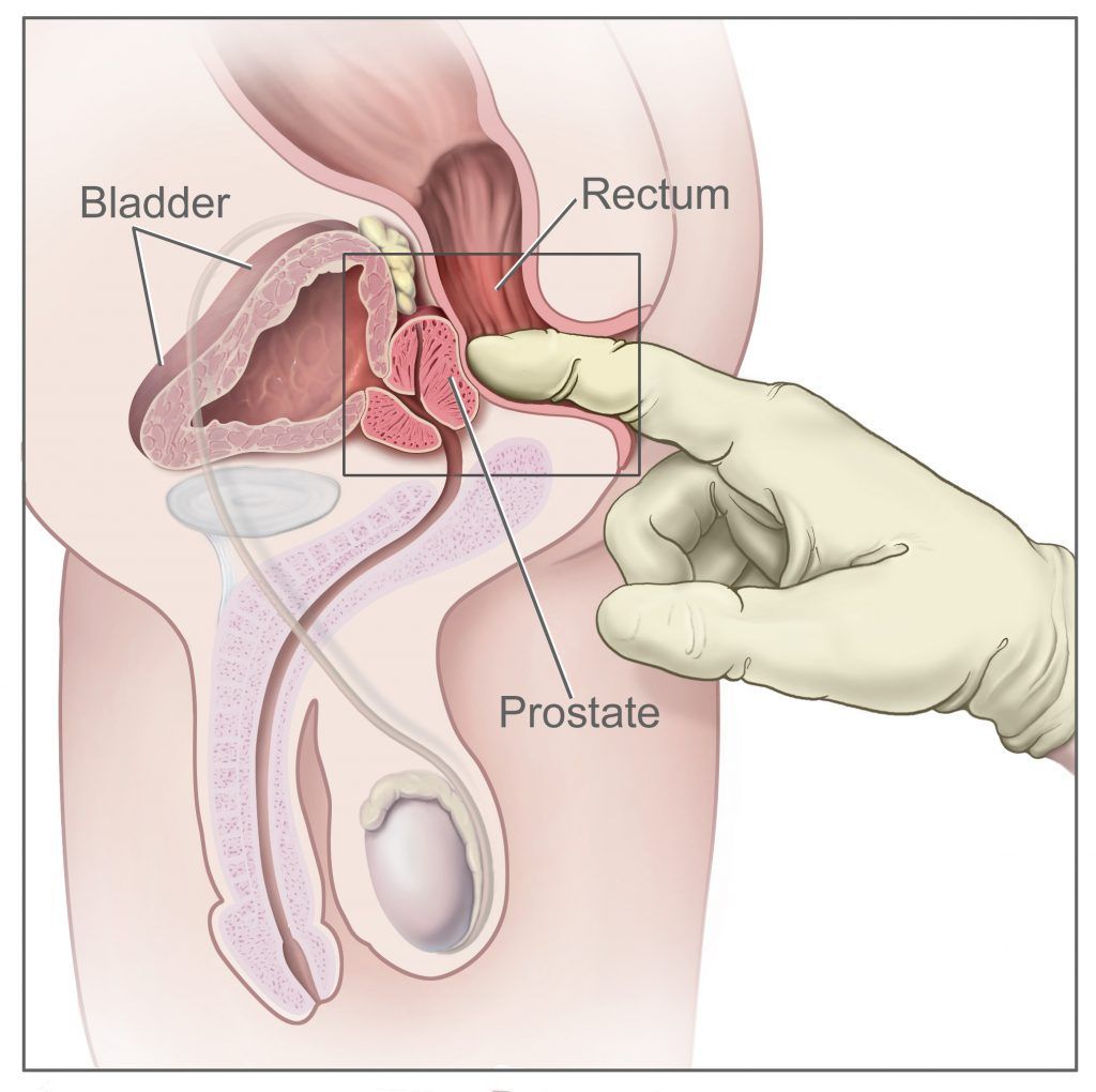 Hog reccomend Male orgasm prostate techniques