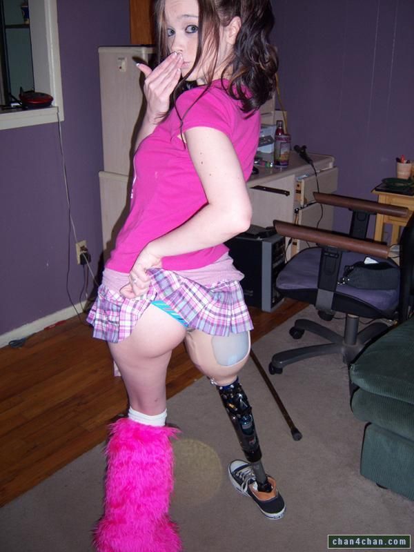Sammie reccomend amputee prosthetic