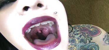 Tart reccomend throat uvula